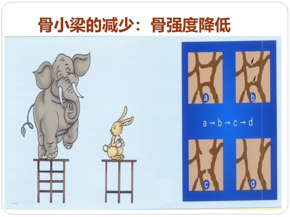 认识骨质疏松(最终版)_第6页