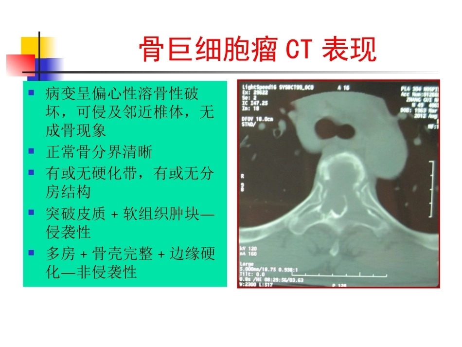 脊柱肿瘤诊断-1_第13页