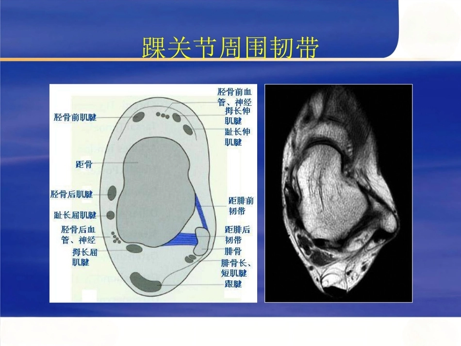 踝关节撞击综合征影像学(2)_第7页