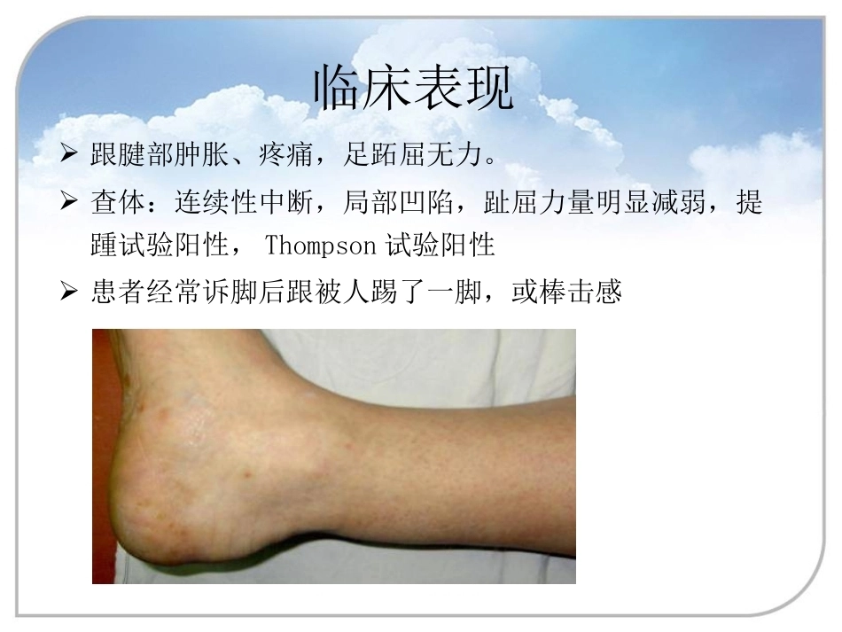 跟腱断裂的诊断与治疗(2)_第12页