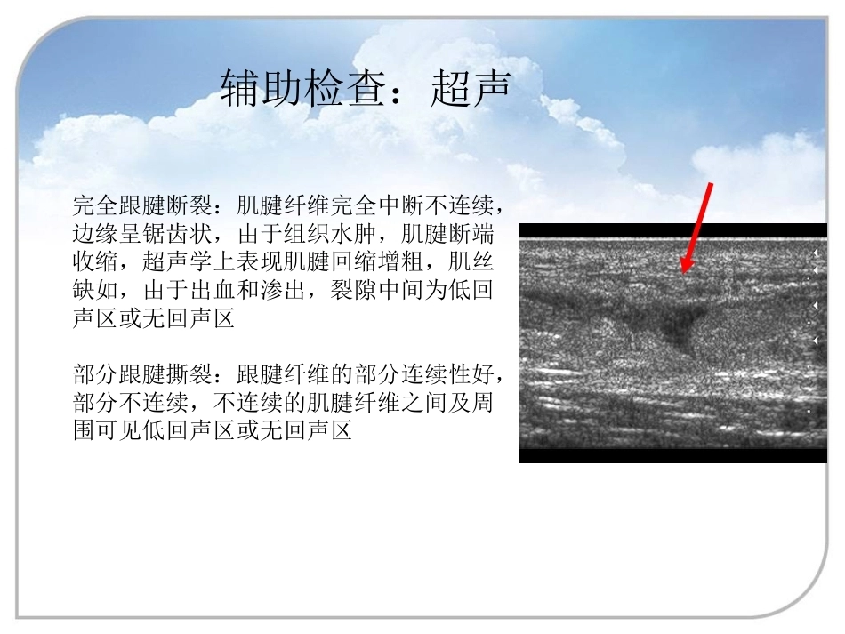 跟腱断裂的诊断与治疗(2)_第15页