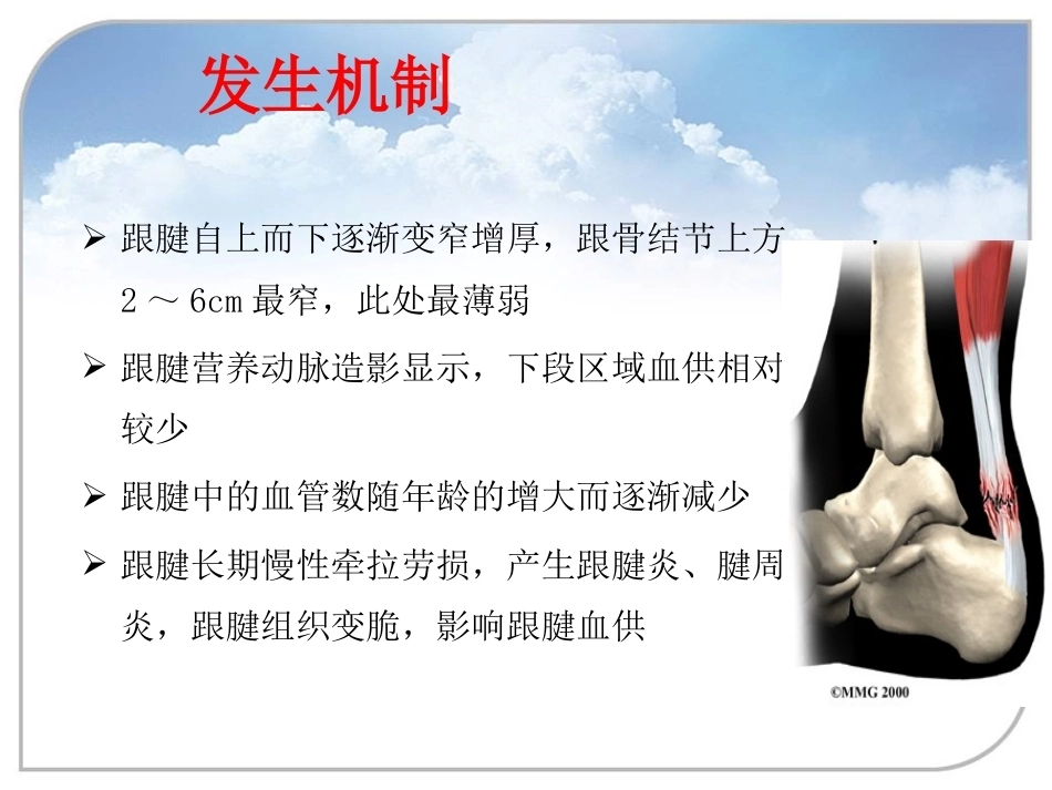 跟腱断裂的诊断与治疗(2)_第9页