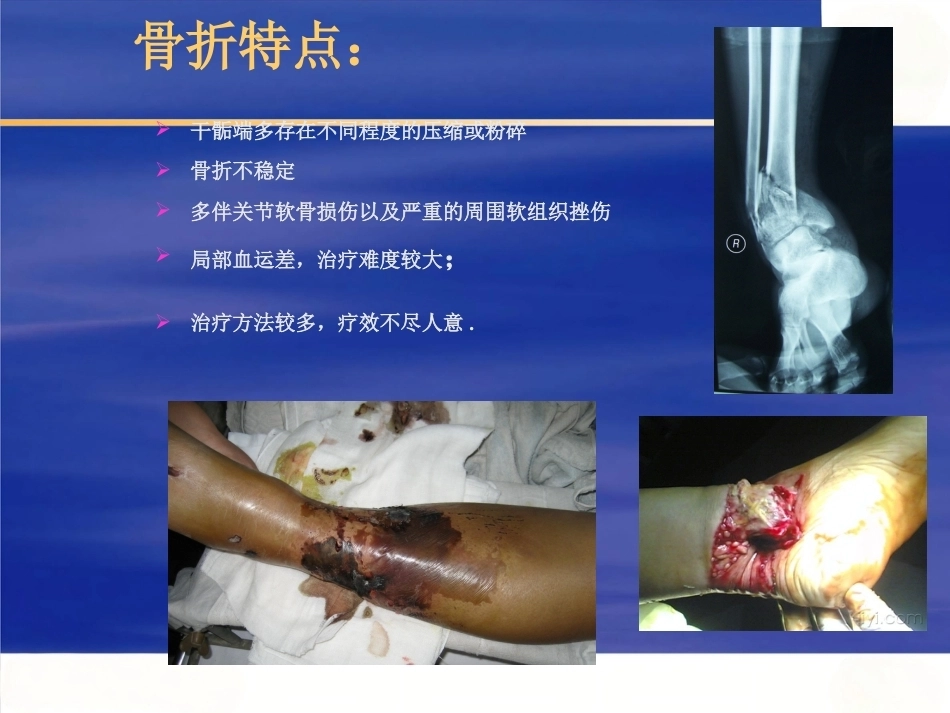 Pilon骨折的治疗(2)_第6页