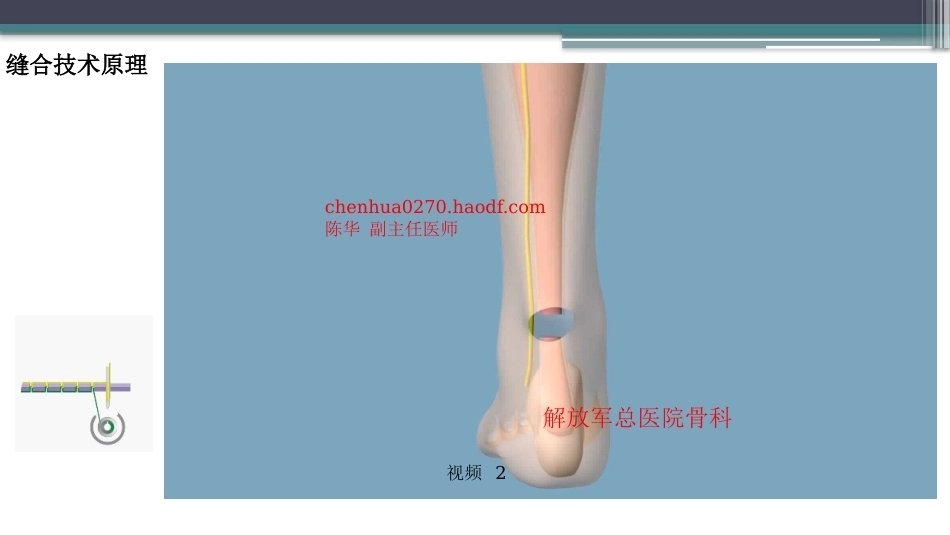 跟腱断裂修复存在的问题及解决新策略(2)_第10页