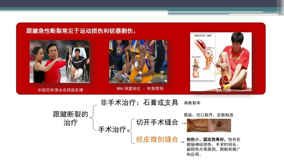 跟腱断裂修复存在的问题及解决新策略(2)_第2页
