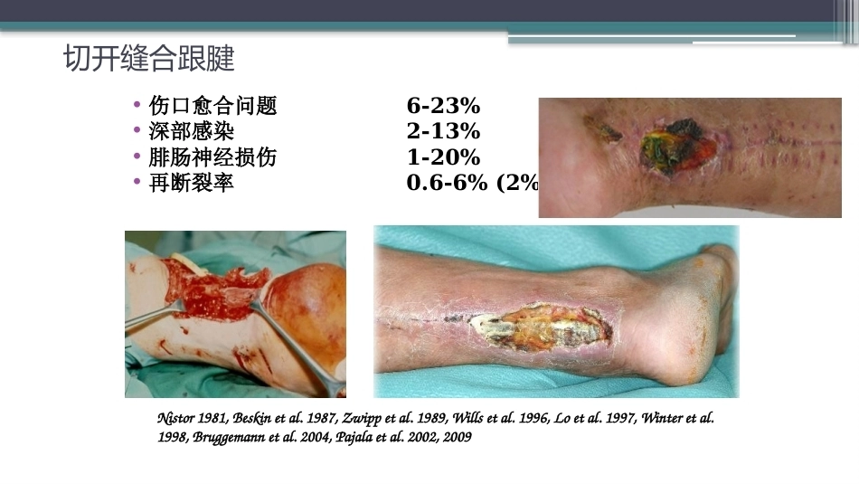 跟腱断裂修复存在的问题及解决新策略(2)_第3页
