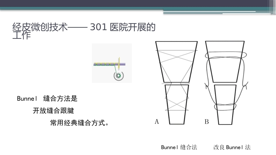 跟腱断裂修复存在的问题及解决新策略(2)_第8页