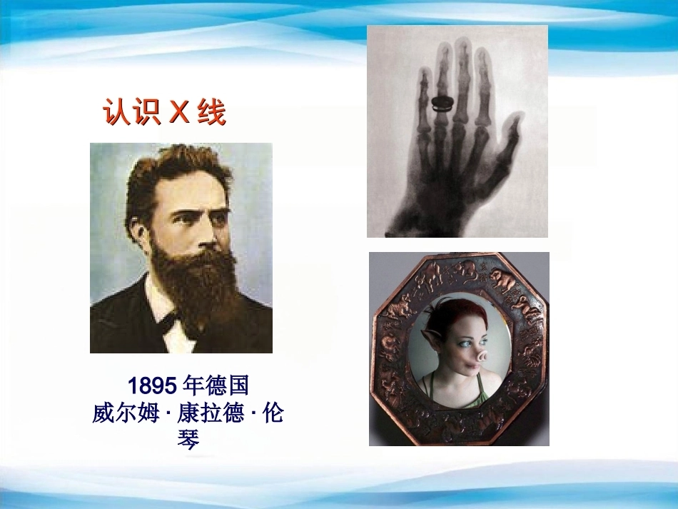 创伤骨科X线片阅片技巧及易漏诊病例讨论(2)_第2页
