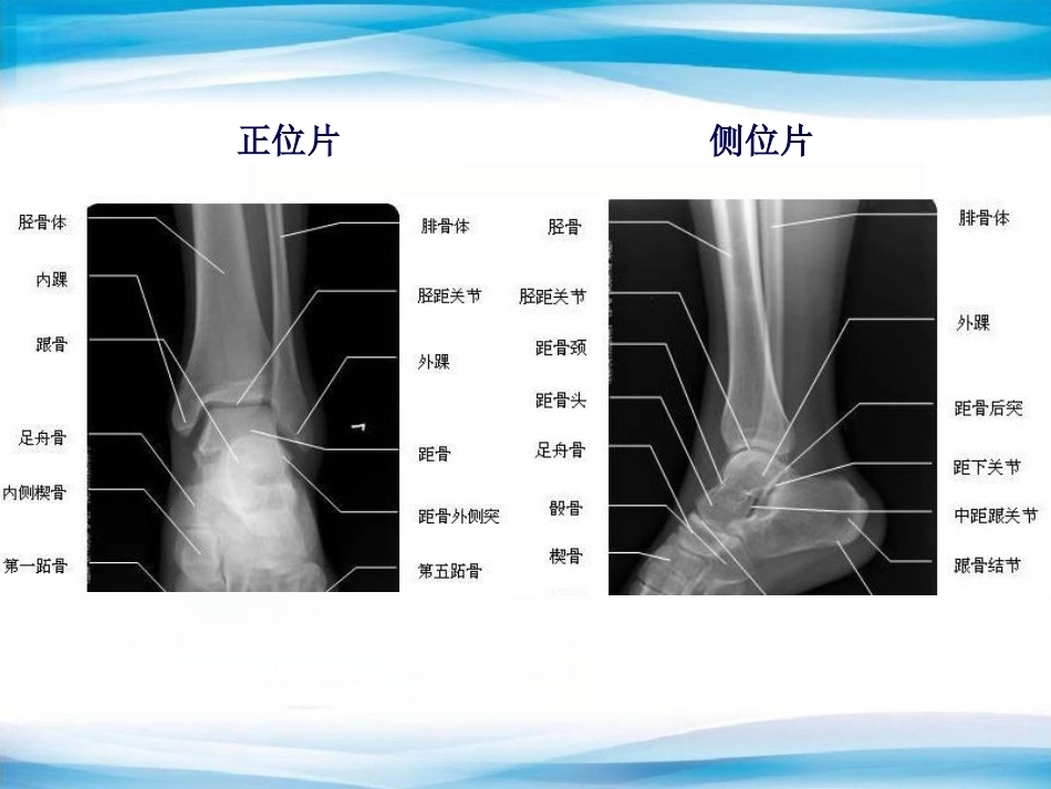 创伤骨科X线片阅片技巧及易漏诊病例讨论(2)_第5页