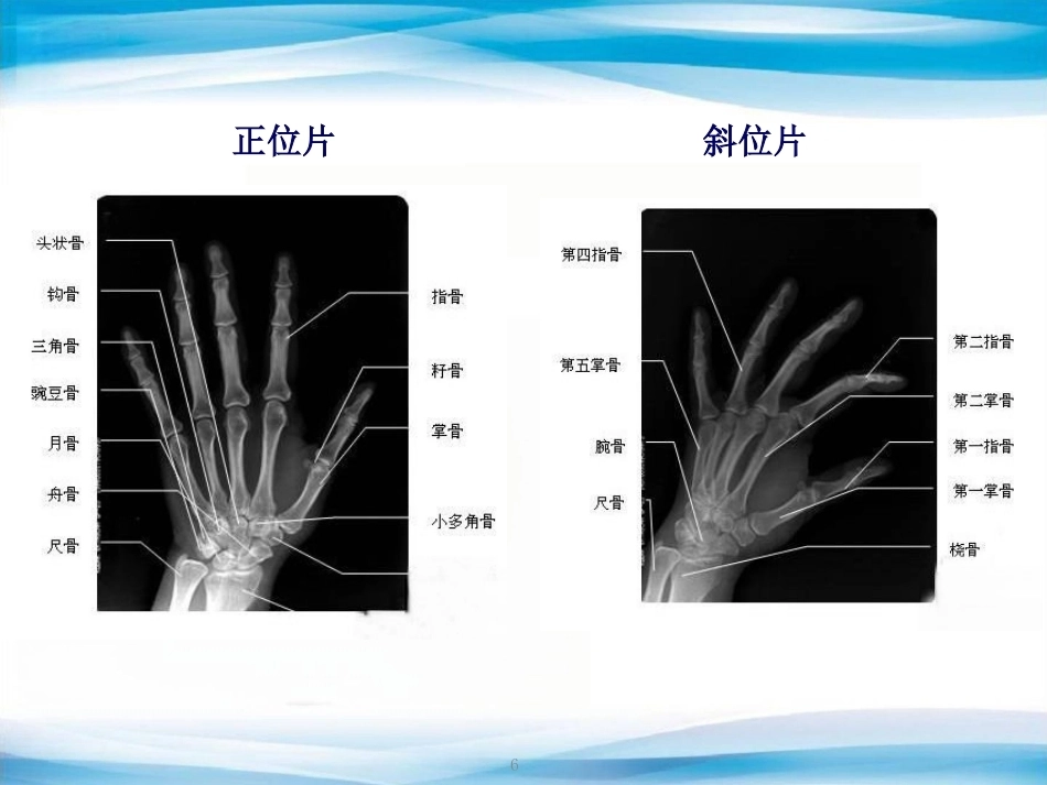 创伤骨科X线片阅片技巧及易漏诊病例讨论(2)_第6页