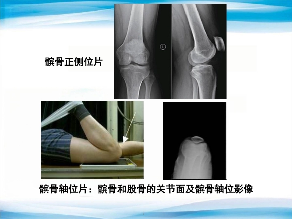 创伤骨科X线片阅片技巧及易漏诊病例讨论(2)_第7页