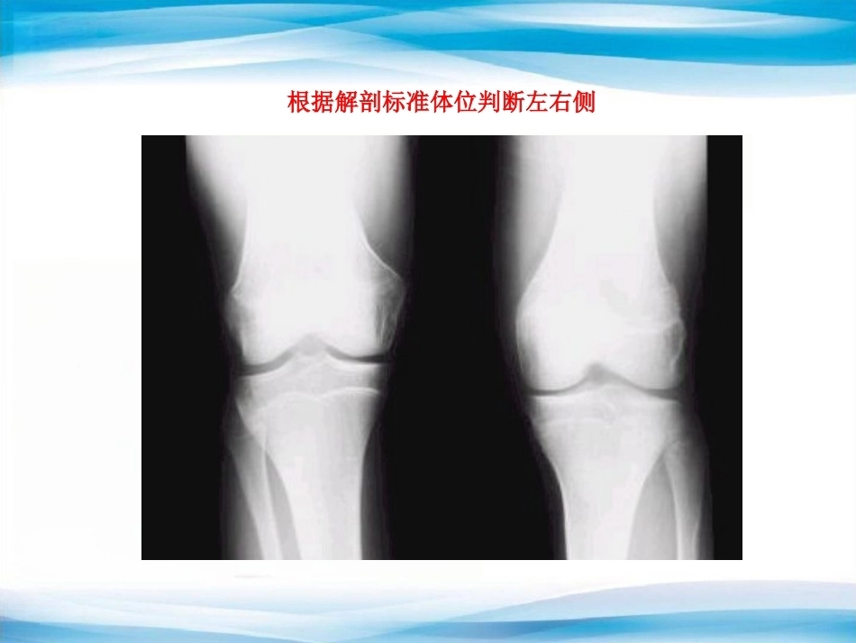 创伤骨科X线片阅片技巧及易漏诊病例讨论(2)_第9页