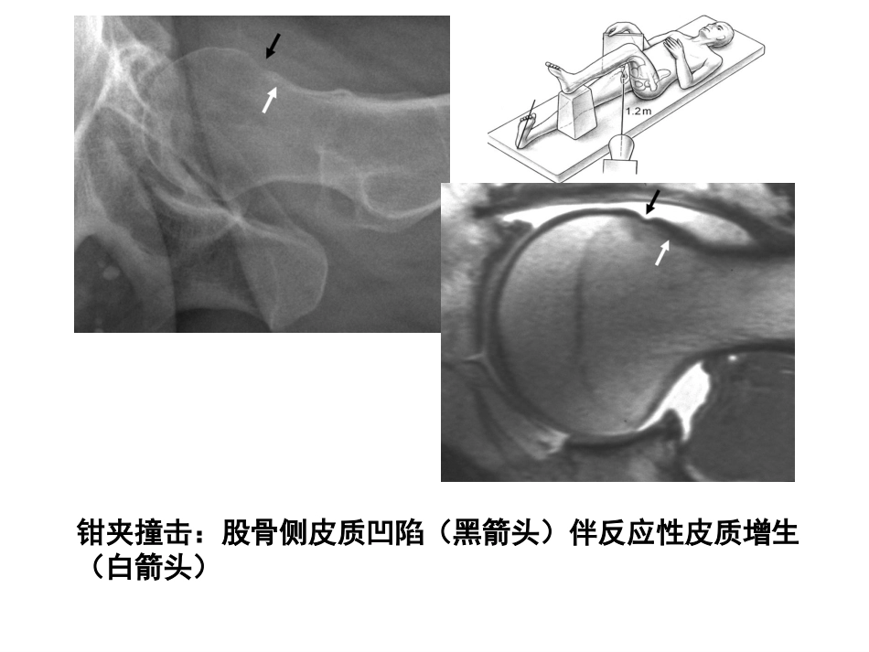 成人影像学(2)_第10页