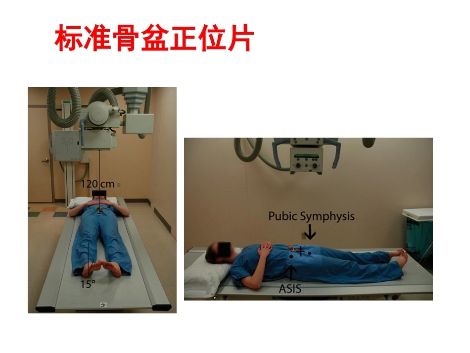 成人影像学(2)_第4页