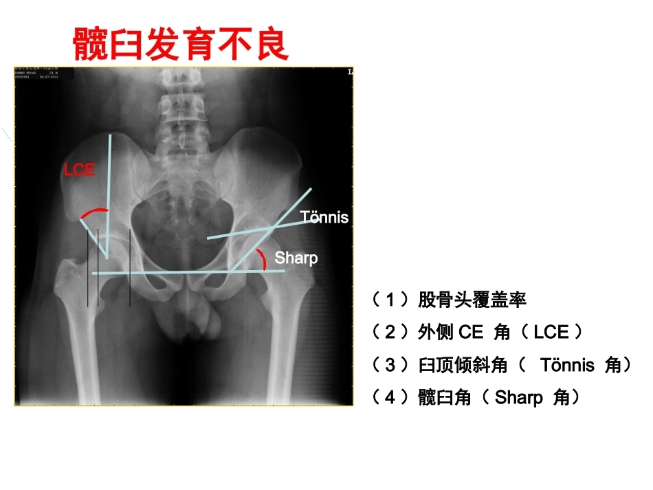 成人影像学(2)_第6页