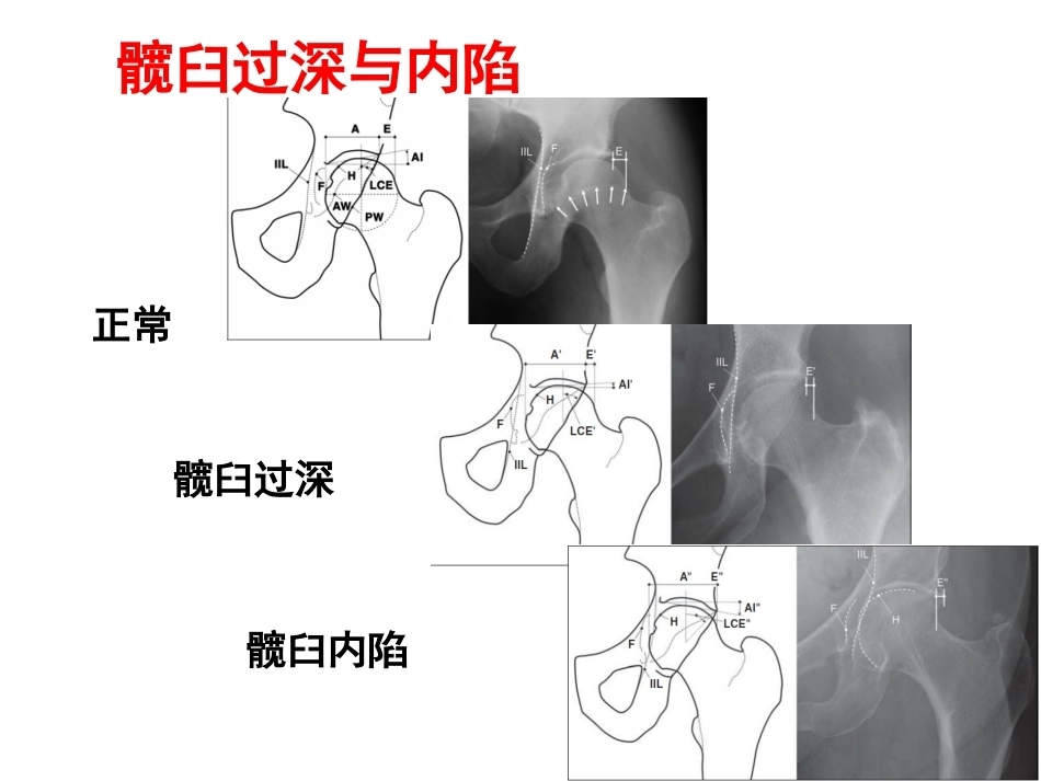 成人影像学(2)_第9页