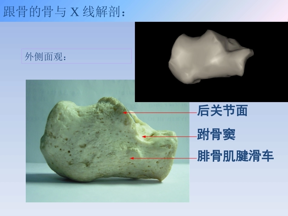 跟骨骨折的治疗(2)_第7页