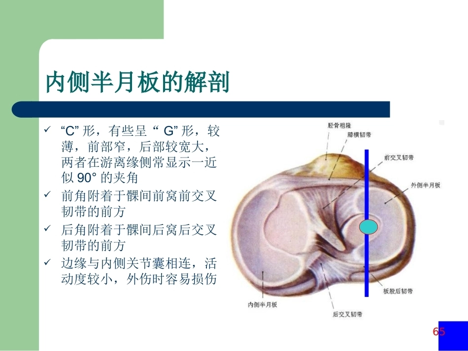 膝关节半月板损伤MRI诊断PPT(2)_第2页