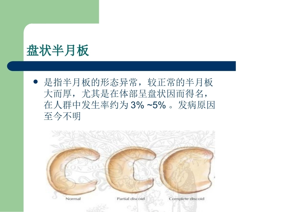 膝关节半月板损伤MRI诊断PPT(2)_第4页