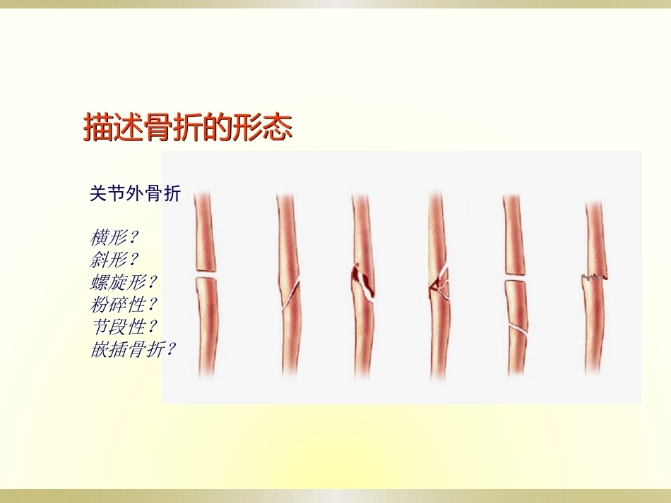 骨科读片基础(2)_第12页