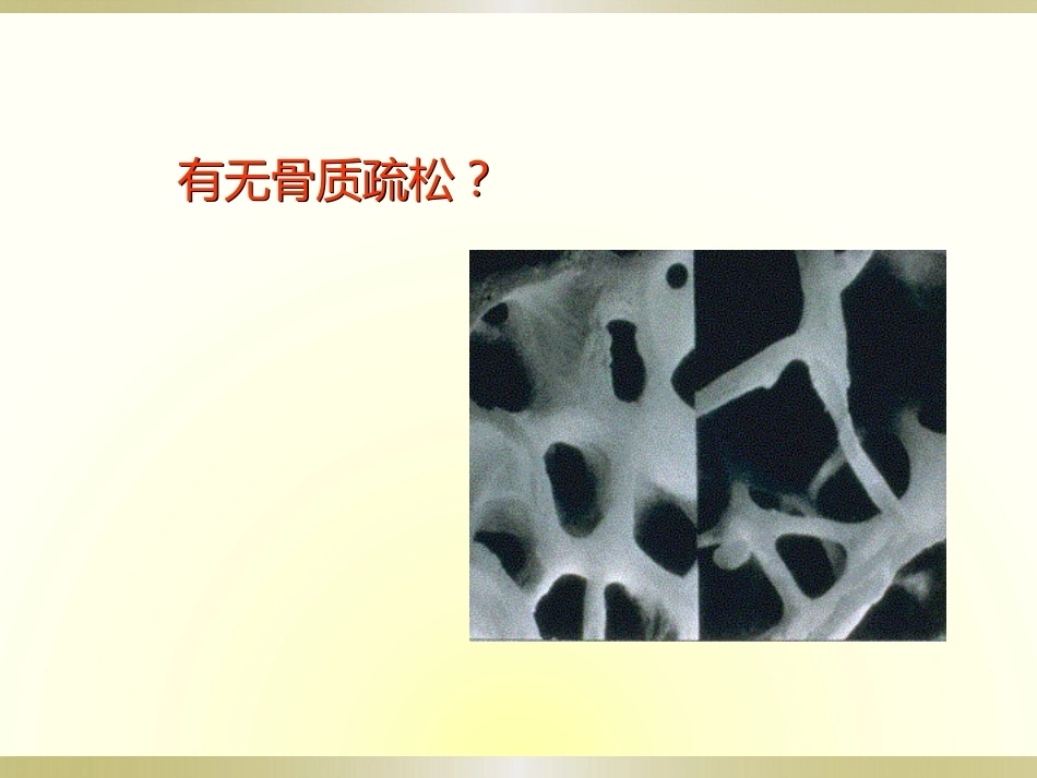 骨科读片基础(2)_第13页