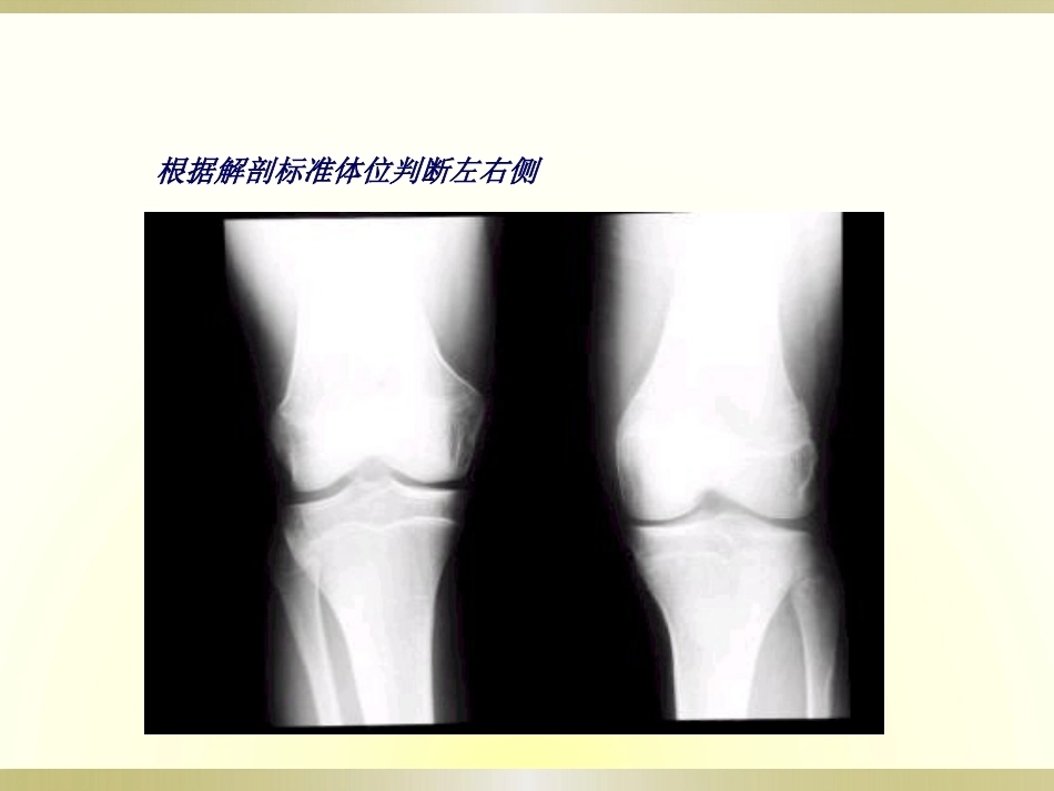 骨科读片基础(2)_第7页