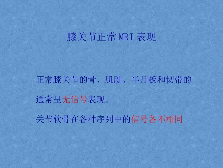 膝关节高清MRI解剖(2)_第3页