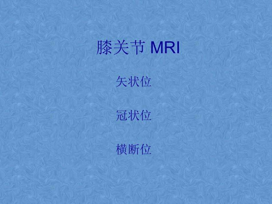 膝关节高清MRI解剖(2)_第4页