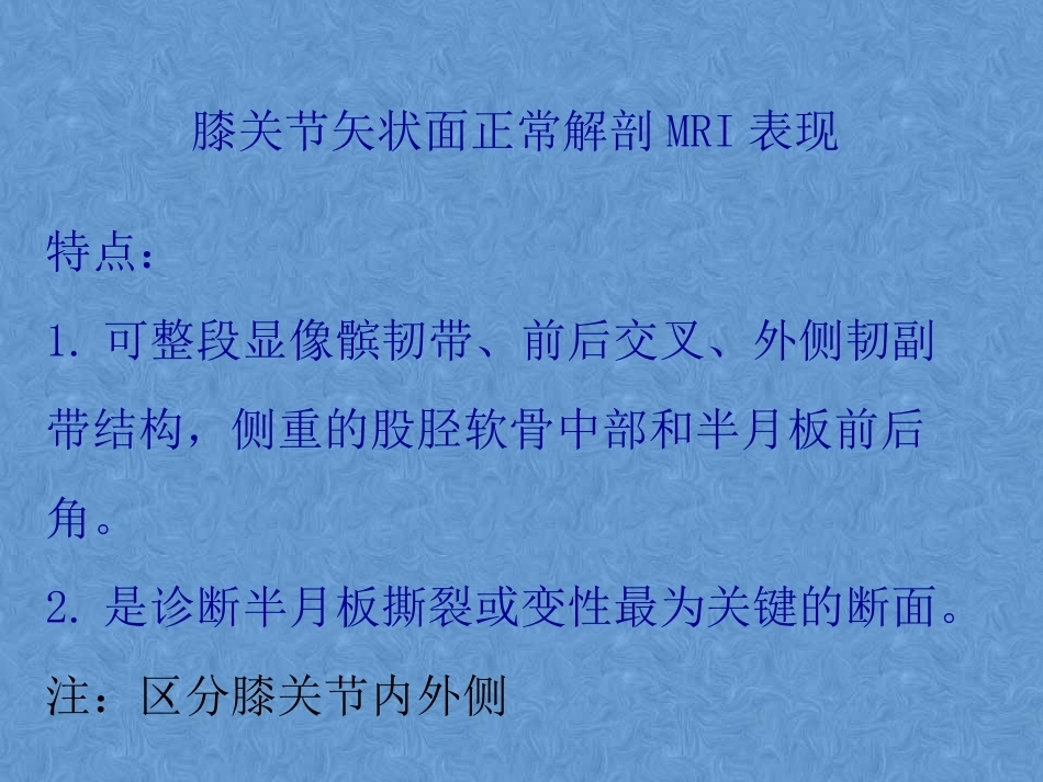 膝关节高清MRI解剖(2)_第5页