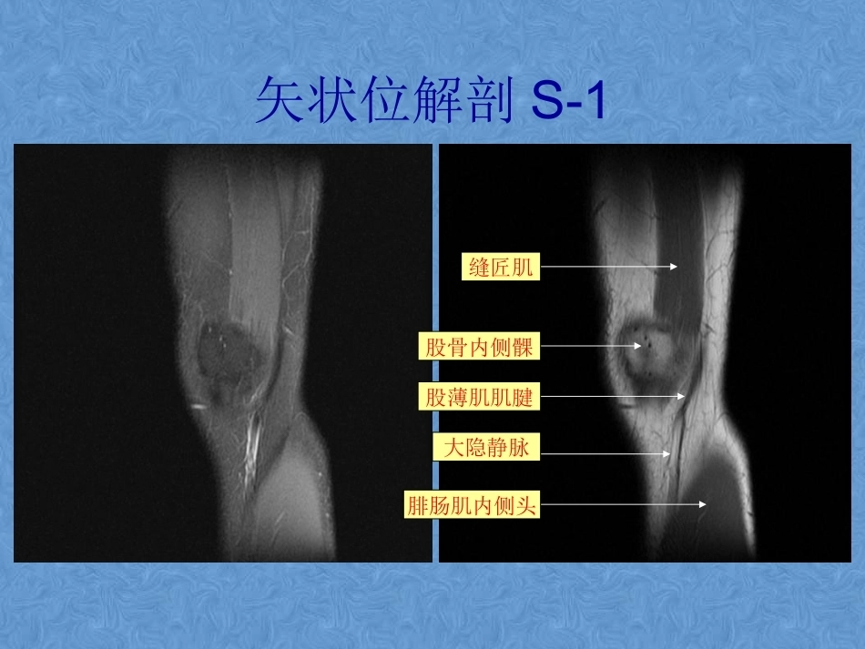 膝关节高清MRI解剖(2)_第7页