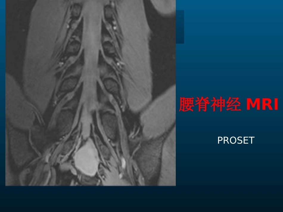 颈椎病的MRI诊断(2)_第11页