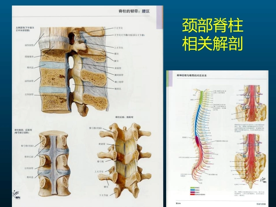 颈椎病的MRI诊断(2)_第5页