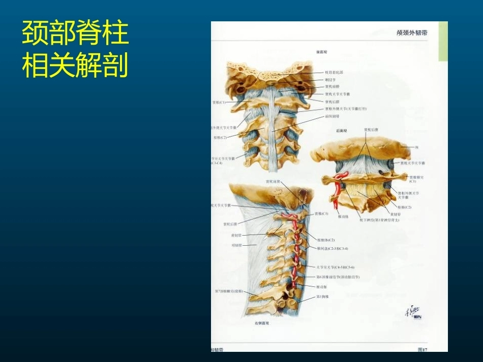颈椎病的MRI诊断(2)_第6页