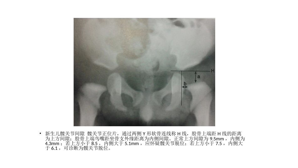 髋关节角度测量(2)_第10页