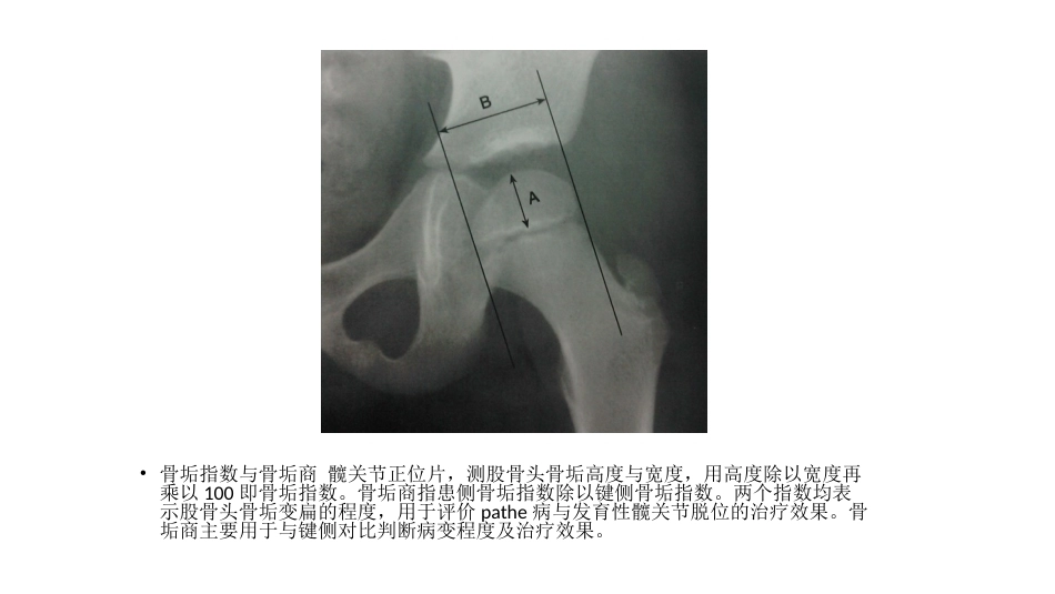 髋关节角度测量(2)_第11页