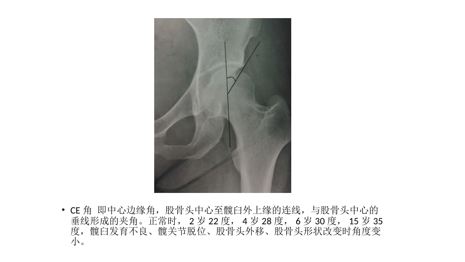 髋关节角度测量(2)_第14页