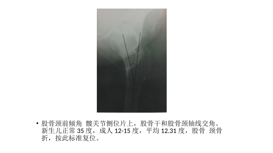 髋关节角度测量(2)_第5页