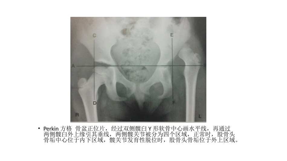 髋关节角度测量(2)_第7页