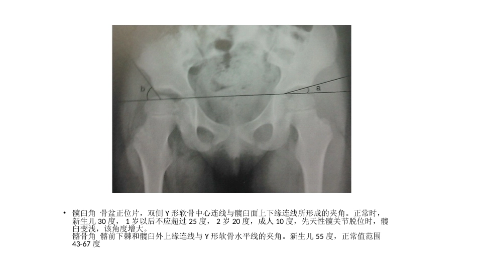 髋关节角度测量(2)_第9页