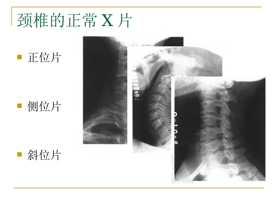 脊柱x片诊断(2)_第3页