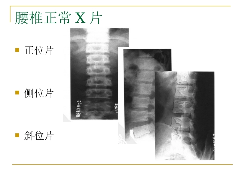 脊柱x片诊断(2)_第5页