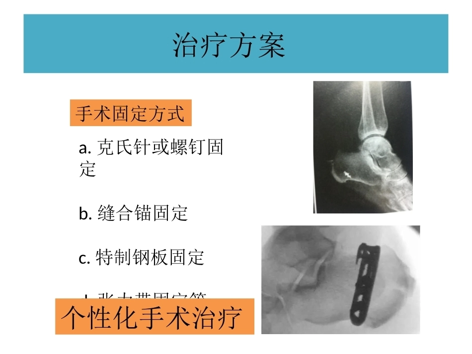 跟骨结节骨折 (2)_第11页