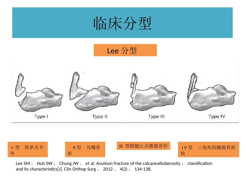 跟骨结节骨折 (2)_第9页