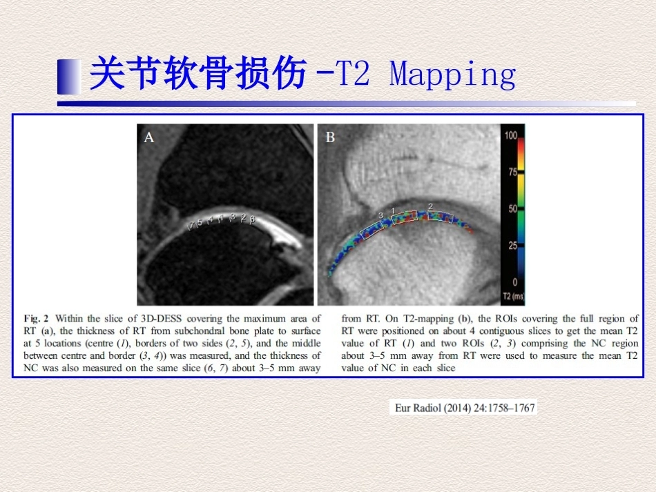 踝关节运动损伤MR诊断(2)_第9页