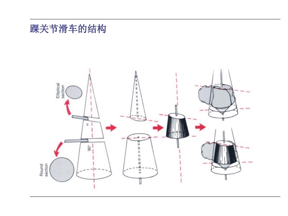 踝关节骨折(2)_第7页