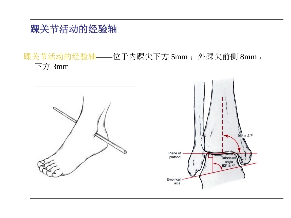 踝关节骨折(2)_第8页