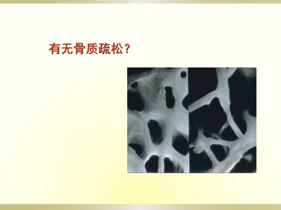 初学者必看骨科读片(2)_第13页