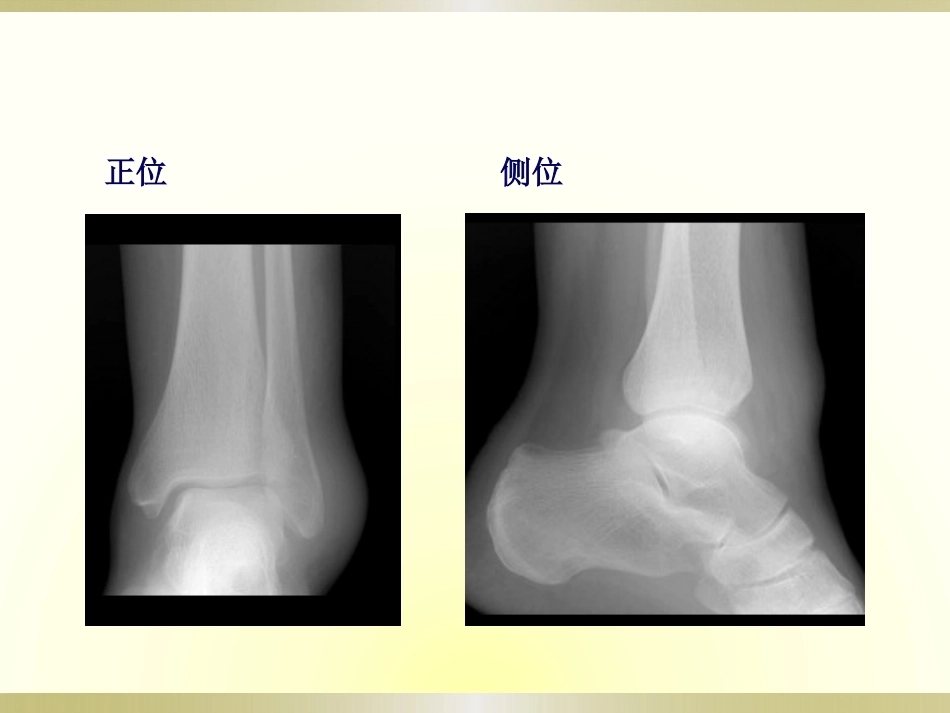 初学者必看骨科读片(2)_第5页