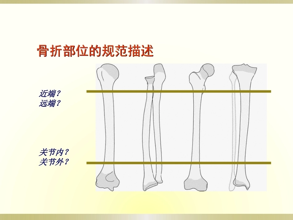 初学者必看骨科读片(2)_第9页