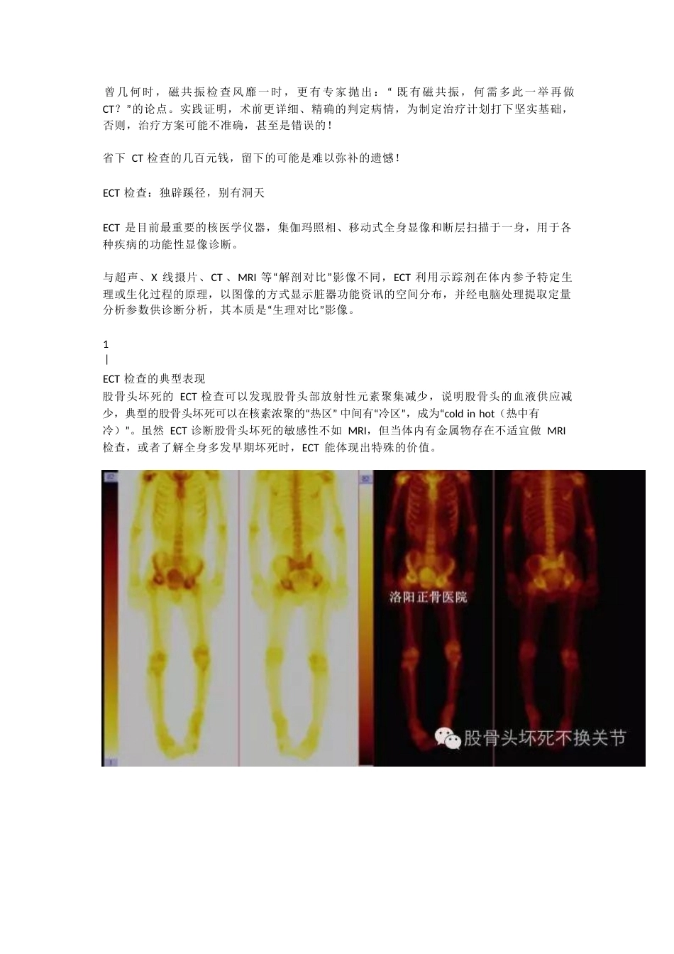 股骨头坏死应该怎样做检查(2)_第12页